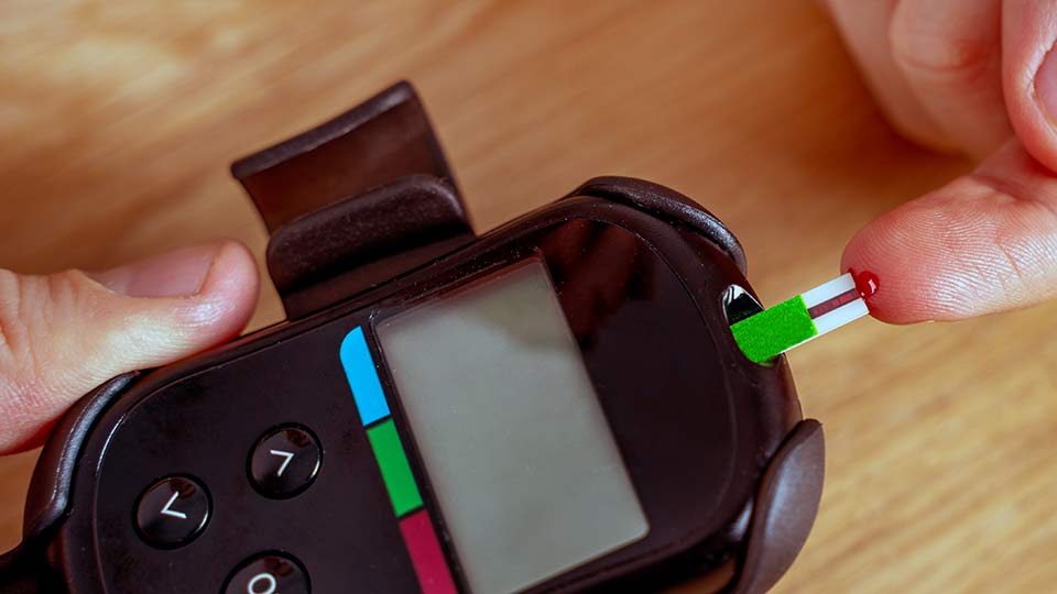 Оддел за третман со инсулински пумпи и сензори