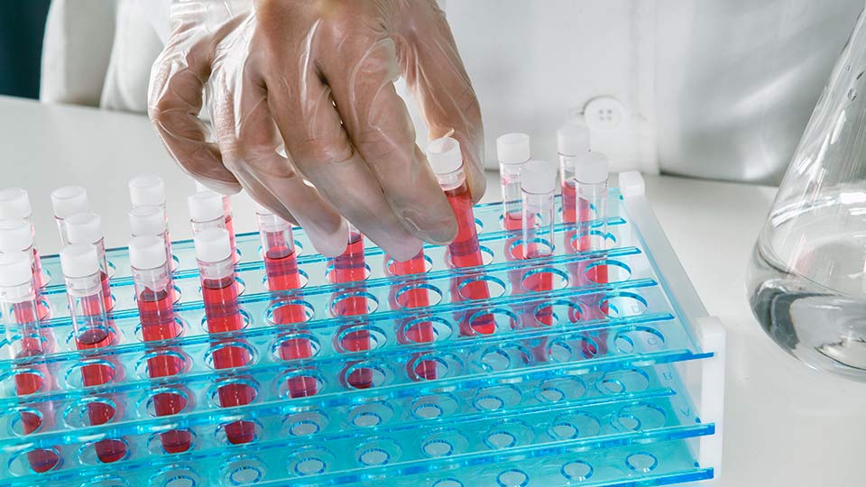 Оддел за специјалистичко-консултативна дејност за дијабетес