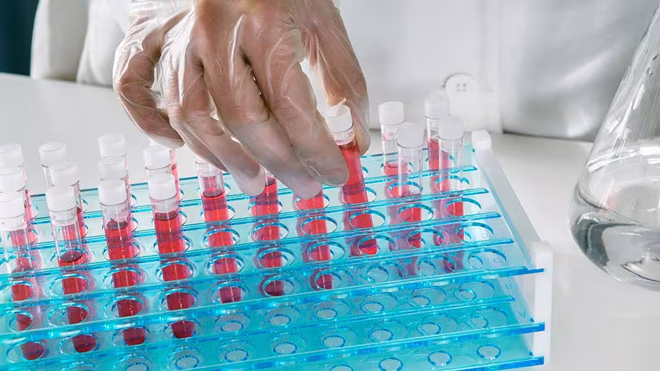 Оддел за специјалистичко-консултативна дејност за дијабетес